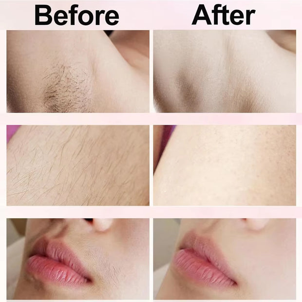 Electric Razor for Women Epilator Painless Hair Removal for Bikini Leg Body Epilator Electric Shaver Woman Face Mustache Trimmer
