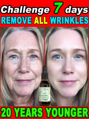 Wrinkles Disappear Become Beautiful Now