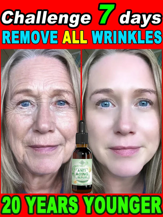 Wrinkles Disappear Become Beautiful Now