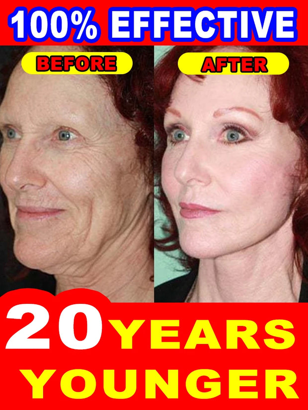 Wrinkles Disappear Become Beautiful Now