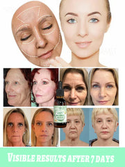 Wrinkles Disappear Become Beautiful Now